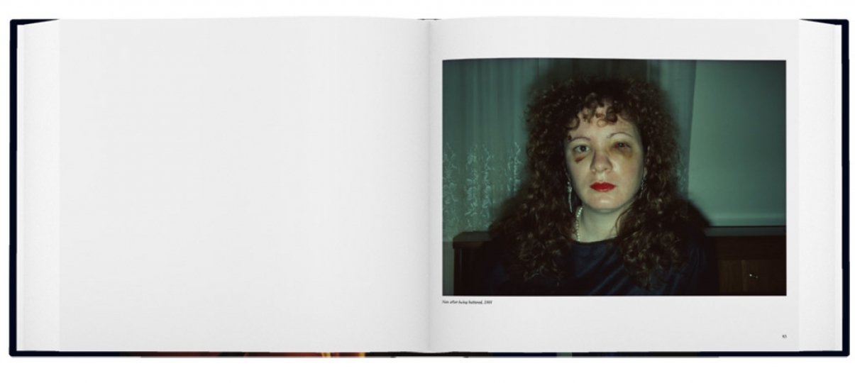 Nan Goldin The Ballad Of Sexual Dependency The Eye Of