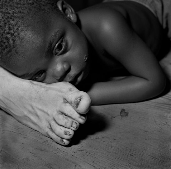 Black child on white foot, 1999 © Roger Ballen