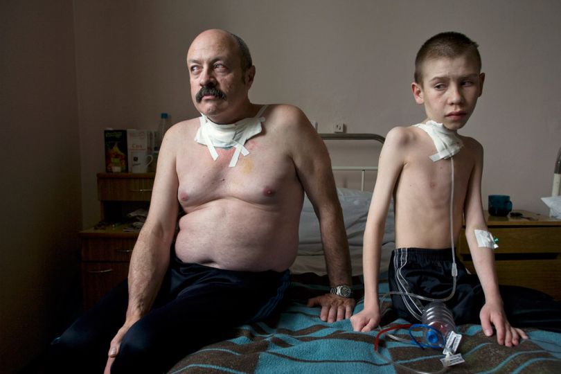 © gerd Ludwig, Minsk, Belarus, 2005. Suffering from thyroid cancer, Oleg Shapiro, 54, and Dima Bogdanovich, 13, receive care at
a thyroid hospital in Minsk.