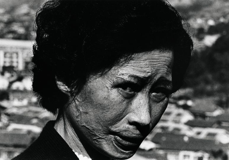 Shomei Tomatsu - Hibakusha Tsuyo Kataoka, Motoharamachi, Nagasaki, 1961 Collection of the estate Shomei Tomatsu – INTERFACE, Okinawa © Shomei Tomatsu –INTERFACE / Courtesy of Taka Ishii Gallery Photography / Film