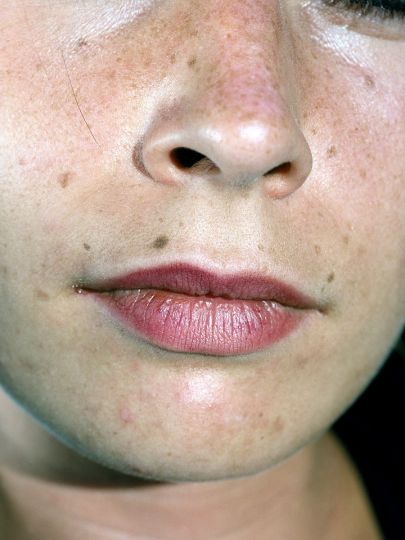 © Lucile Boiron