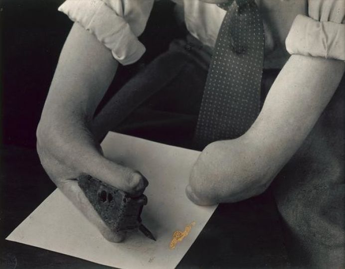 August SANDER, Mains d’un grand blessé de guerre, 1946, papier baryté au gélatino-argentique, 16,3 × 21,7 cm, achat, 1988, inv. : 88.5.3 © MAMC+, 2021