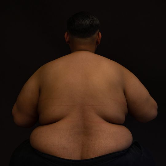 Le corps gros © Bertrand Perret