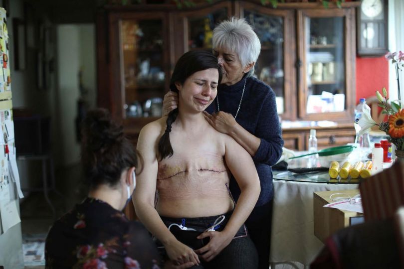MEXICO CITY (MEXIQUE), 07/08/2021.- Sandra Monrroy, 36 ans, 3 jours après avoir subi une mastectomie bilatérale due à un cancer du sein. Son amie Gina Ramirez (l) et sa mère Teresa Mandrujano (r) l'accompagnent alors qu'elle enlève le bandage qui a été placé sur sa poitrine. / MEXICO CITY (MEXICO), 07/08/2021.- Sandra Monrroy, 36, 3 days after undergoing a bilateral mastectomy due to breast cancer. Her friend Gina Ramirez (l) and her mother Teresa Mandrujano (r) accompany her as she removes the bandage that was placed on her breast. © Sáshenka Gutiérrez