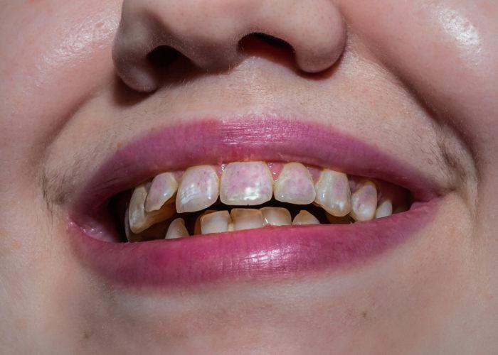 Nika Sander : Une histoire de dents